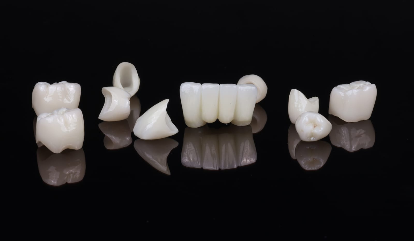A group of ceramic crowns and a four unit fixed dental bridge photographed on a black reflective surface before fitting.