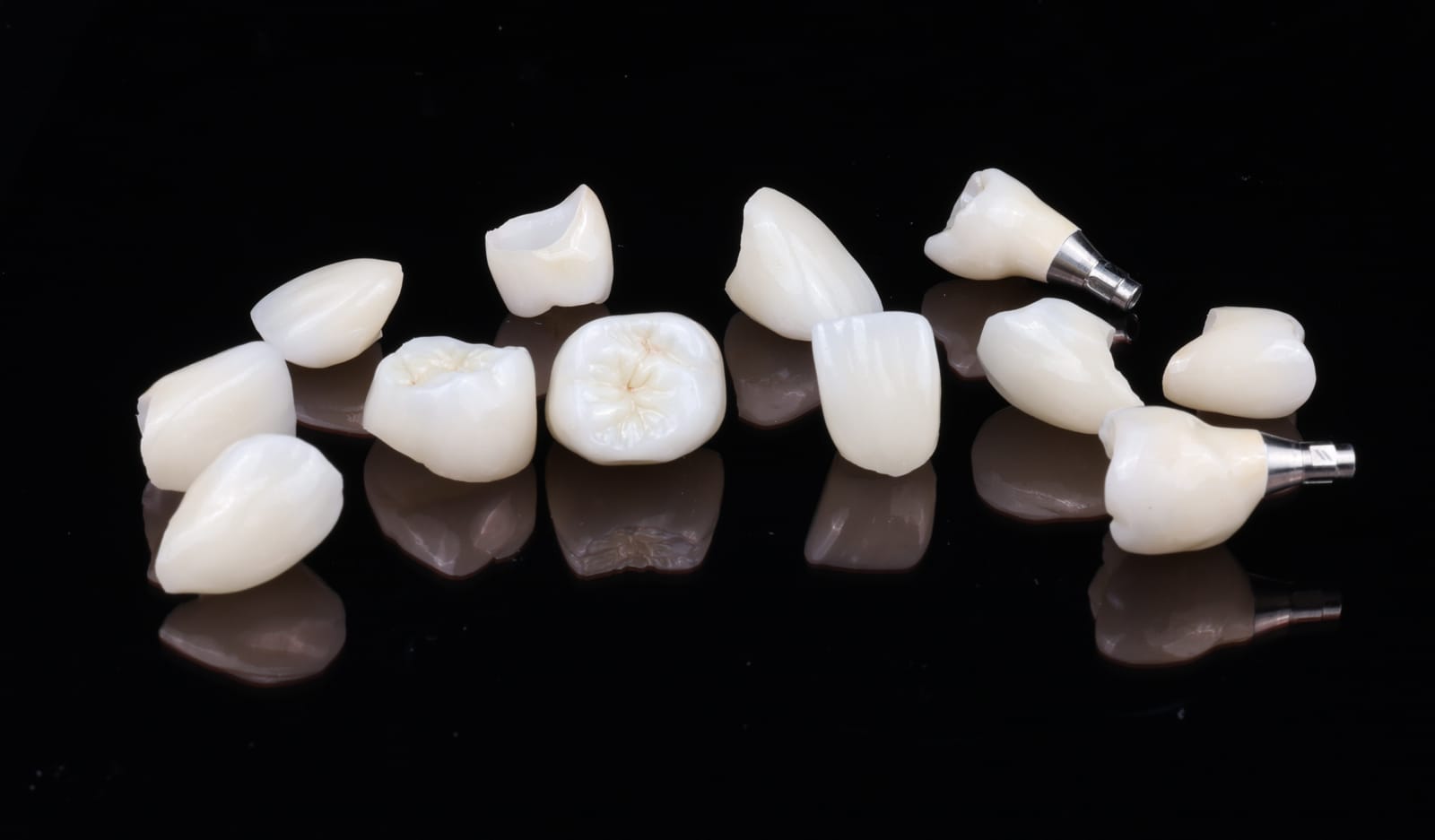 Ceramic crowns and an onlay photographed on black, including two implant crowns with titanium abutments attached.