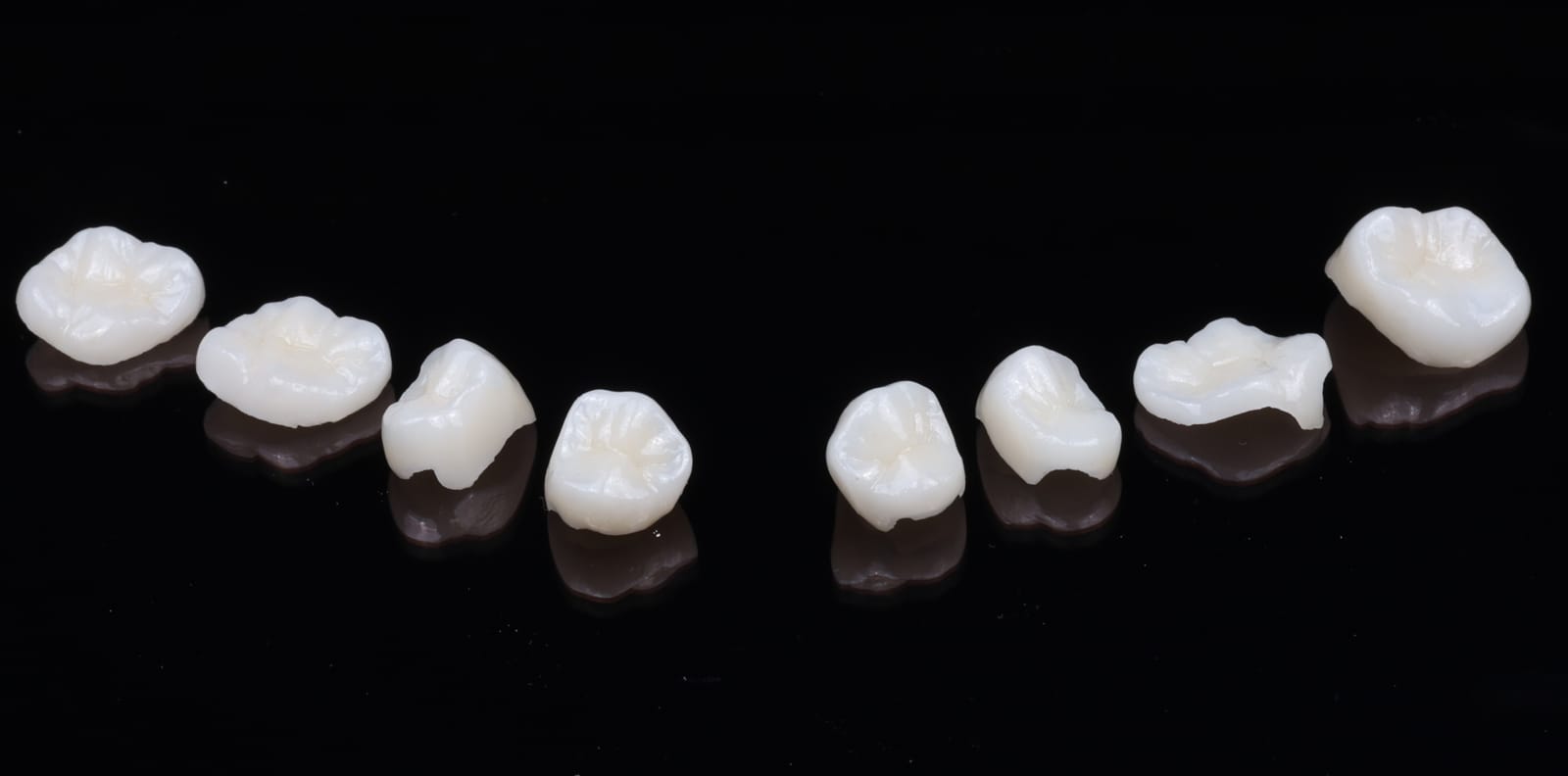 Ceramic onlays and partial coverage restorations for posterior teeth, photographed on a black reflective surface.