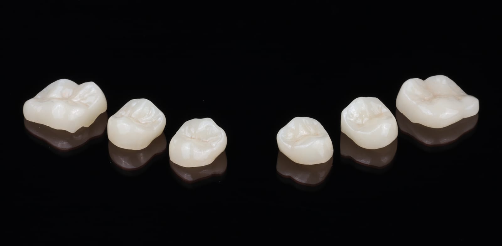 A set of ceramic onlays for posterior teeth photographed on a black reflective surface, showing the milled occlusal anatomy.