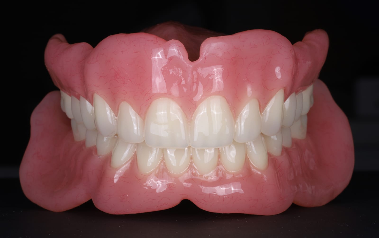 Complete upper and lower dentures in occlusion, photographed on a black reflective surface, showing the acrylic denture bases and denture teeth.