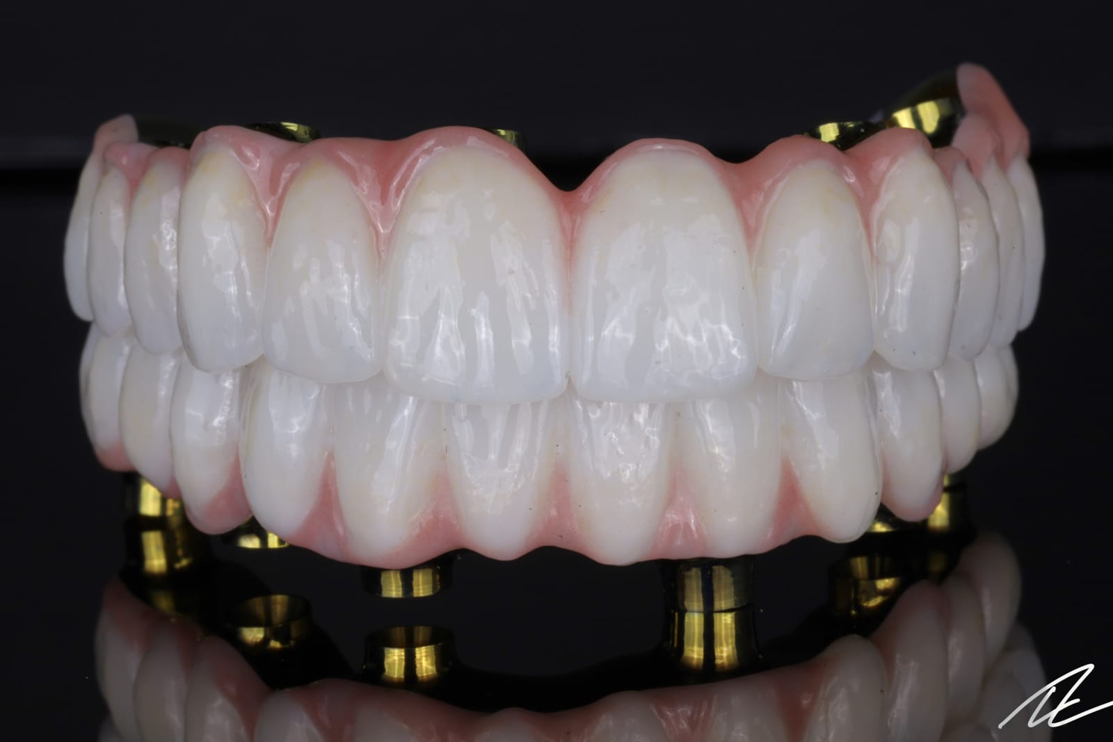 Upper and lower implant supported fixed dental prostheses in occlusion, photographed on black, showing layered ceramic teeth and gingival coloured ceramic.