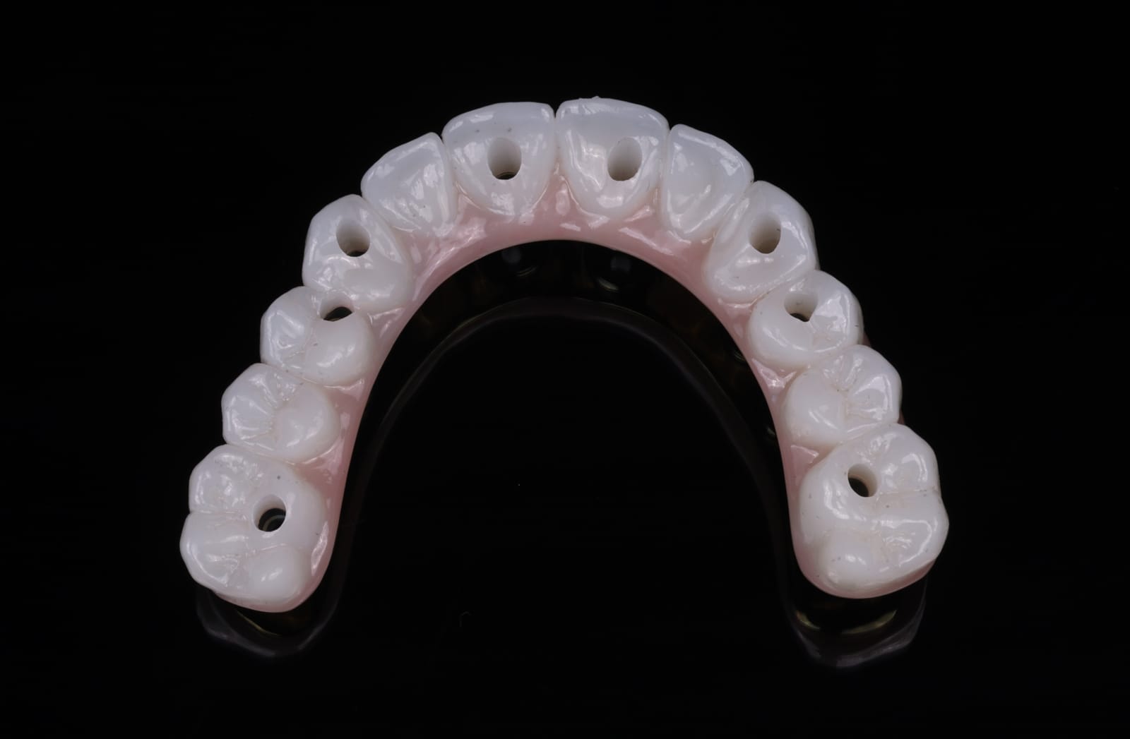 Occlusal view of an upper implant supported fixed dental prosthesis showing the screw access channels through the zirconia.