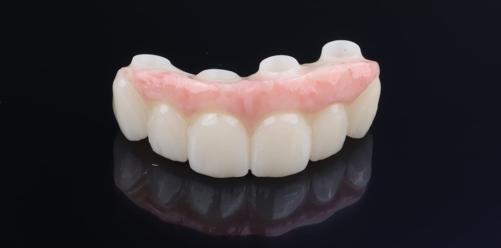Anterior implant supported fixed partial denture with gingival coloured ceramic, photographed on a black reflective surface.
