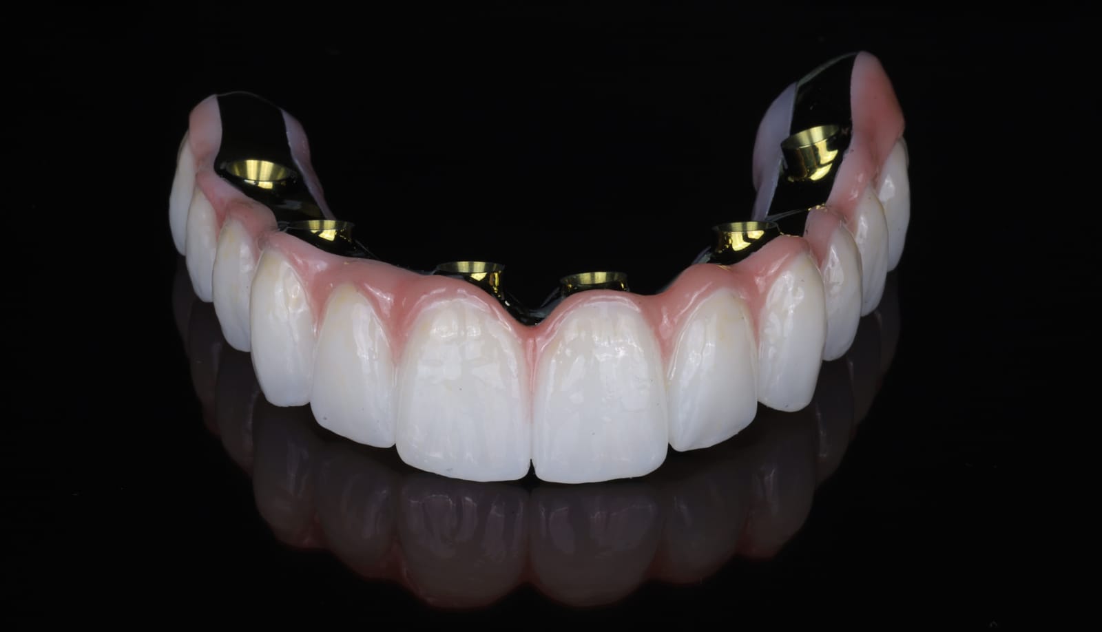 Lower implant supported fixed dental prosthesis with gingival coloured ceramic and gold titanium abutment cylinders, photographed on black.