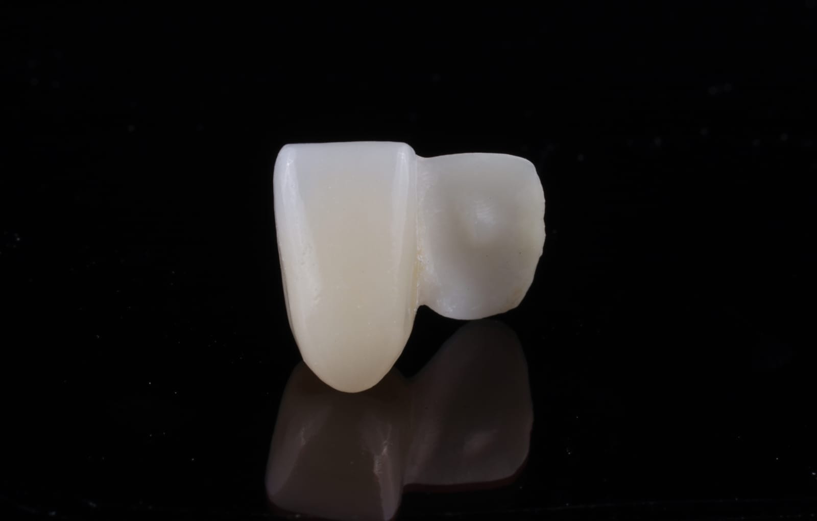A resin bonded bridge, also called a Maryland bridge, photographed on a black reflective surface showing the bonding wing behind the replacement tooth.