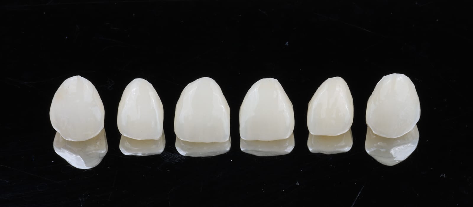 Six anterior ceramic crowns in a row on a black reflective surface, photographed before fitting.