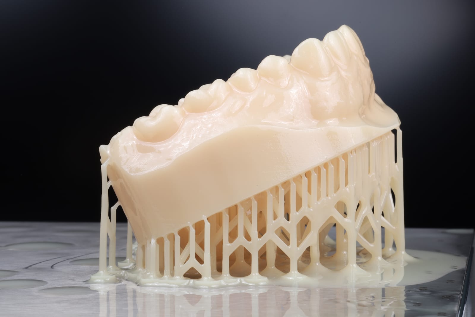 A three dimensionally printed dental model of an upper arch, shown still attached to the lattice of printed support struts it was built on, with uncured resin still on the surface.