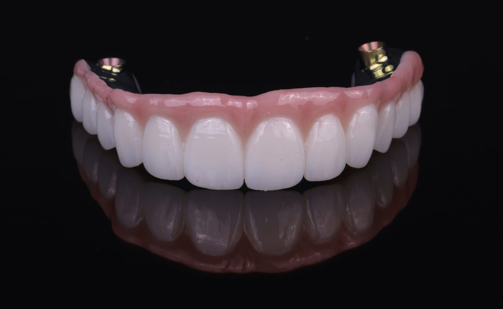 Upper implant supported fixed dental prosthesis in zirconia with gingival coloured ceramic, photographed on a black reflective surface.